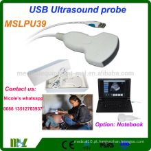 MSLPU39i Multi-frequência e fácil de operar usb convex probe / usb ultra-sonografia para gravidez